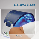 Cellule